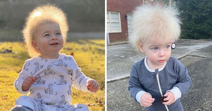 Счастливый малыш с синдромрм нерасчесываемых волос доказывает, что плохих волос не бывает