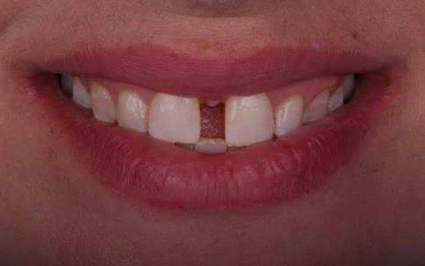 3. "Dişlerimin arasında büyük bir boşluk var. Dilimi oraya sıkıştırıp bıraktığımda kırılan kemik sesine benzer acayip bir ses çıkarabiliyorum."