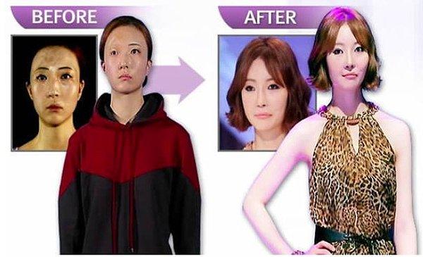 9. Güney Kore'de yayınlanan bir estetik programına yüzünün sol kısmındaki yaralarını değiştirmek için katılan genç kadın;