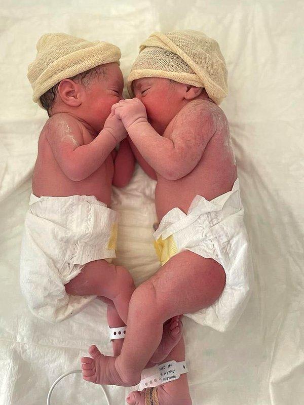 İkiz bebeklerin sağlıklı olduğunu belirten kadın doğum uzmanı, ekip olarak çok keyif aldıklarını ekledi.