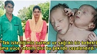 Milyonda Bir Görülen Bir Vaka: İki Kafalı, Üç Kollu ve İki Kalpli Doğan Bebek Görenleri Şoka Uğrattı!