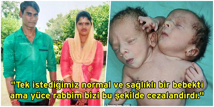 Milyonda Bir Görülen Bir Vaka: İki Kafalı, Üç Kollu ve İki Kalpli Doğan Bebek Görenleri Şoka Uğrattı!