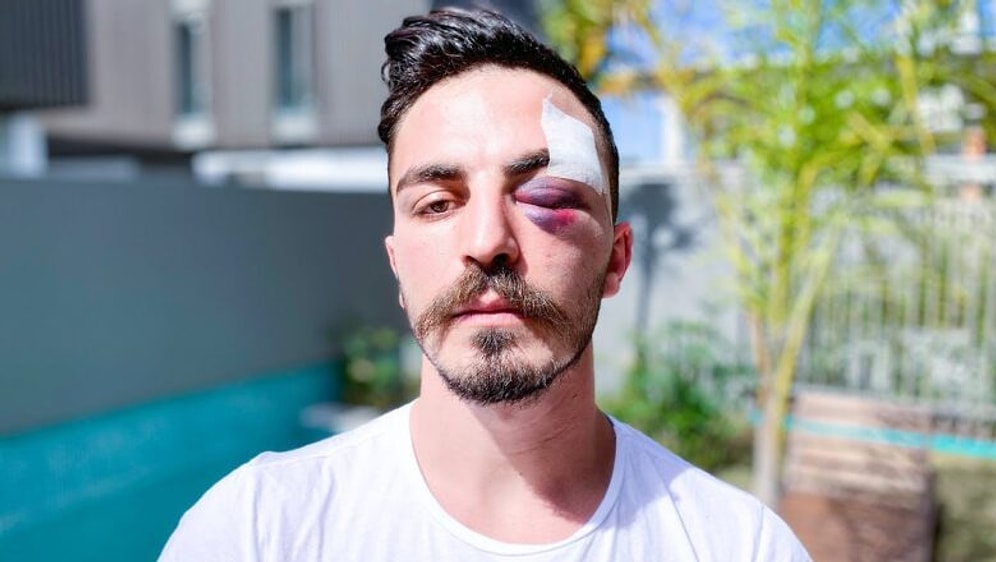 Fenomen Partisinde 'Deli Mi Ne?' ile 'Yeisso' Arasında Büyük Kavga Çıktı: Burak Güngör Tüm Gerçekleri Açıkladı