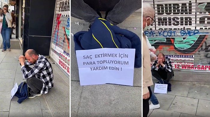 Allah Başka Dert Vermesin: Saç Ektirebilmek İçin Sokakta Ağlayarak Dilenen Adam