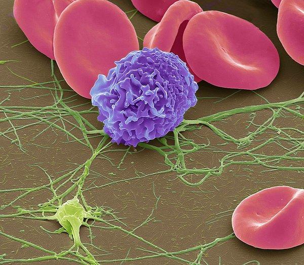 12. Kırmızı kan hücreleri, tek bir beyaz kan hücresi ve fibrin iplikçikleri olan bir trombosit: