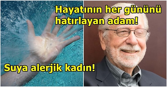 Hayatının Her Anını Hatırlayan Adamdan Acıyı Hissetmeyen Kadına! Mantık Kurallarına Aykırı Olan Tıbbi Gizemler