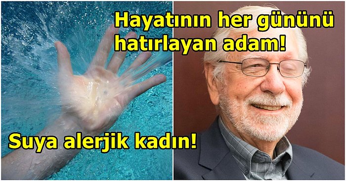 Hayatının Her Anını Hatırlayan Adamdan Acıyı Hissetmeyen Kadına! Mantık Kurallarına Aykırı Olan Tıbbi Gizemler