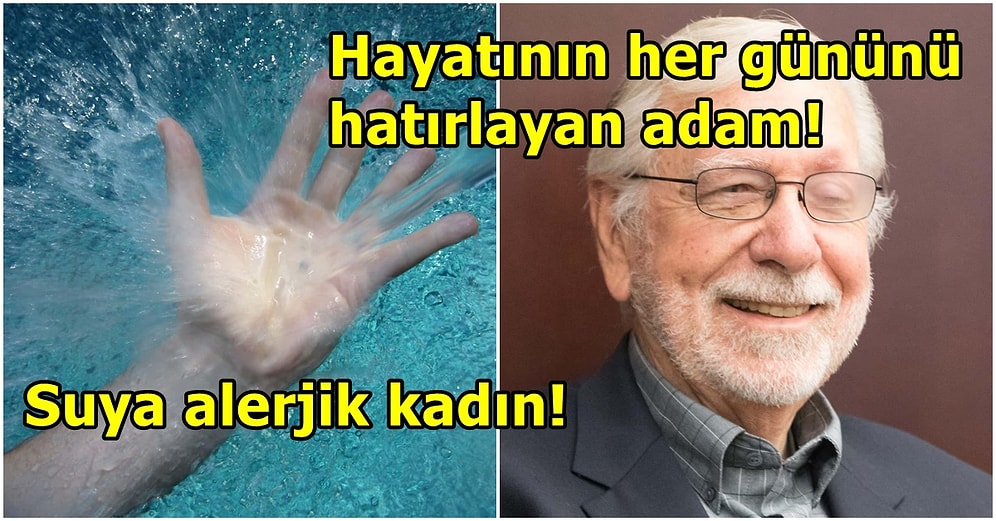 Hayatının Her Anını Hatırlayan Adamdan Acıyı Hissetmeyen Kadına! Mantık Kurallarına Aykırı Olan Tıbbi Gizemler
