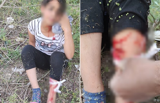 Sokak Köpeklerinin Saldırdığı Kız Çocuğu Yaralandı