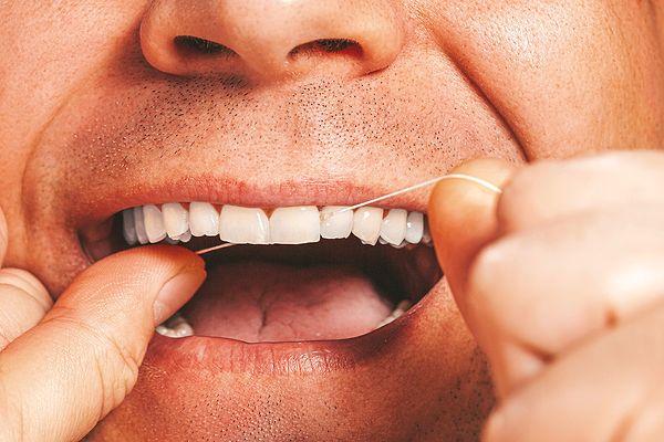 5. Plakları çıkarmak için diş ipi kullanın.