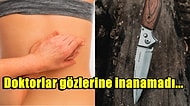 Yıllardır Çektiği Sırt Ağrısı Şikayeti ile Hastaneye Giden Adam Sırtındaki Bıçağı 26 Yıl Sonra Fark Etti!
