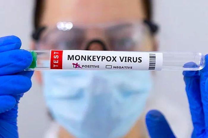 Türkiye’de Maymun Çiçeği Virüsü Tespit Edildi mi? Maymun Çiçeği Hangi Ülkelerde Görüldü?