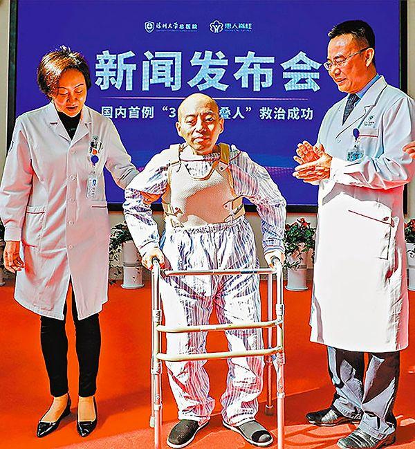 Li Hua, 2020 yılında geçirdiği ameliyat sayesinde 25 yıl sonra, 46 yaşındayken ayağa kalkabildi.