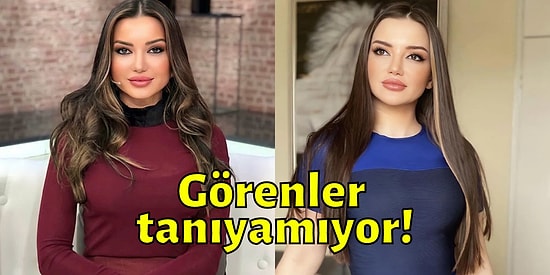 Yayınladığı İtiraflarla Gündem Olan Ünlü Psikolog Esra Ezmeci'nin Estetiksiz Hali Ortaya Çıktı!