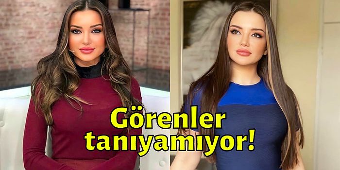 Yayınladığı İtiraflarla Gündem Olan Ünlü Psikolog Esra Ezmeci'nin Estetiksiz Hali Ortaya Çıktı!