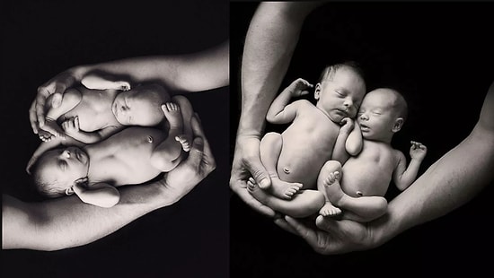 Они настолько близки, что слов не нужно: 30 снимков о жизни и крепкой связи близнецов