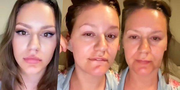 Yüz Germe Bantları Kullanan Kadının Makyajını ve Bantları Çıkartınca Bambaşka Birine Döndüğü Video Gündem Oldu