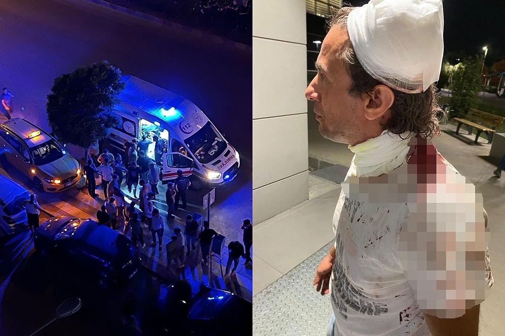 Manisa'da Alkollü Yolcu Dehşeti! Isırdı, Darbetti, Aracına Binip Kaza Yaptı