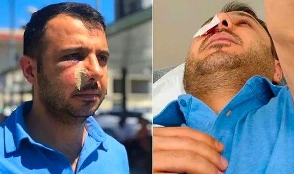 10. Sağlık çalışanlarına yönelik saldırıların ardı arkası kesilmiyor. Son olay İstanbul Bağcılar Eğitim Araştırma Hastanesi'nde yaşandı. Kimliksiz kayıt yaptırmak isteyen hasta yakını, sağlık çalışanlarına saldırdı.