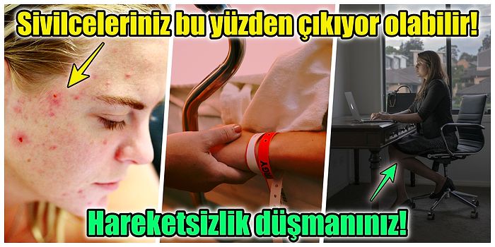 Sivilce Probleminden Kaygı Bozukluğuna… Gün Boyunca Aralıksız Oturursanız Vücudunuzda Neler Olur?