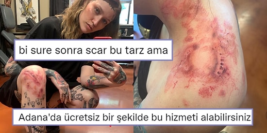 Dikiş ve Yara İzi Olarak Tasarladığı Dövmelerle Sektöre Yeni Bir Soluk Getiren Sanatçı Sarah Jean ile Tanışın!