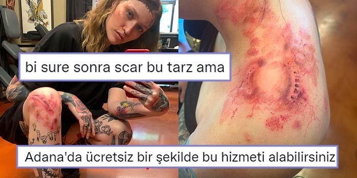 Dikiş ve Yara İzi Olarak Tasarladığı Dövmelerle Sektöre Yeni Bir Soluk Getiren Sanatçı Sarah Jean ile Tanışın!