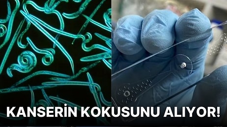 Bir Solucan Türü Kanserin Kokusunu Alıp Yok Etmek İçin Eğitiliyor