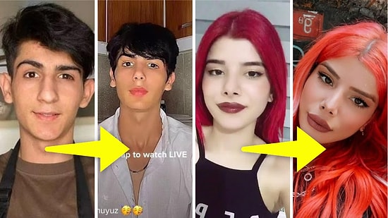 Ailesi Bile Onları Tanıyamıyor: Taha Duymaz'dan Mika Raun'a TikTok Fenomenlerinin Estetik Yolculukları