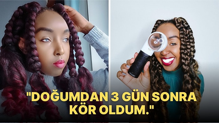 Doğum Yaptıktan Sonra Görme Yetisini Kaybeden Kadının Herkese Örnek Olacak Hayata Tutunma Hikayesi