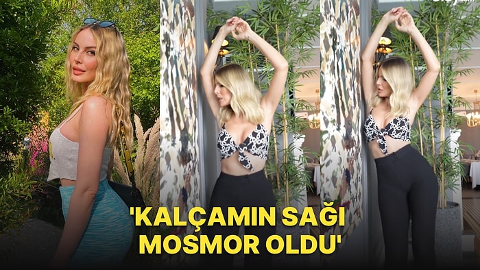 Hande Sarıoğlu Yeni Programını Böyle Duyurdu: 'Kalçamın Sağı Mosmor'