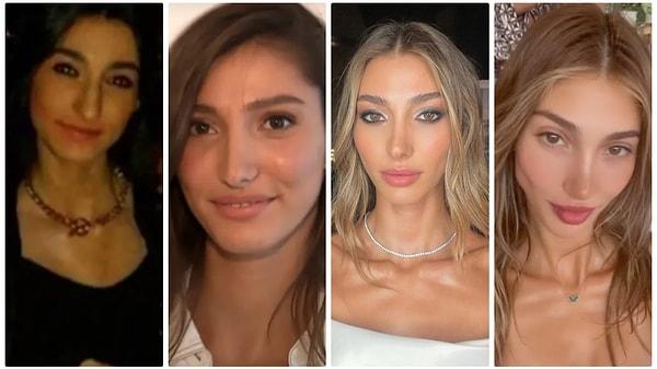 Miss Turkey 2018 birincisi Sevval Şahin, estetikleri yüzünden gündeme oturmuştu.