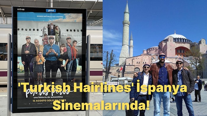 Şöhreti Türkiye'yi Aşan Saç Ektirme Tedavisi İspanya Sinemasında Yer Alacak: Turkish Hairlines