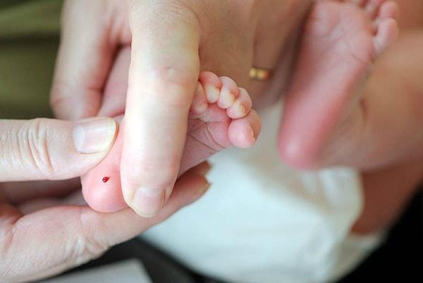 Topuk tarama testleri bebeğin hayatının ilk aylarında belirti vermeyen ancak ileride bebek için ciddi sonuçlar doğurabilecek doğumsal hastalıkların tespiti amacıyla yapılır.