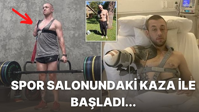 Bir Kolunu Kaybetti! Spor Salonunda Geçirdiği Kaza Sonrasında Yakalandığı Enfeksiyonla Hayatı Değişen Adam