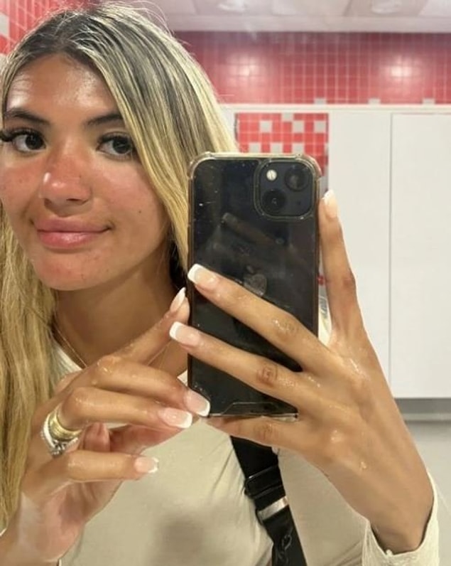21 derece sıcağın altında uyuyakalan genç kadın, aslen bir güzellik uzmanı. Güneş yanığını dert etmeyen Sirin, ertesi gün aynaya bakınca şoke oldu!