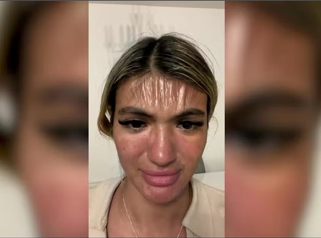 Alnındaki derinin kabardığını gören Sirin, kaşlarını çattığında cildinin plastiği andırdığını fark etti.