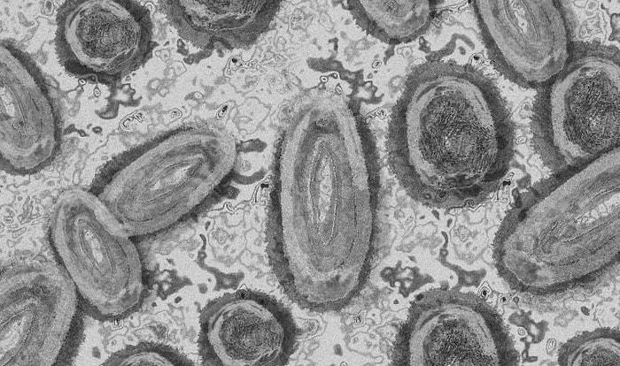 Ölümcül Virüslerin 3'ü Bir Arada! Covid-19, Maymun Çiçeği ve HIV Testleri Aynı Gün Pozitif Çıktı