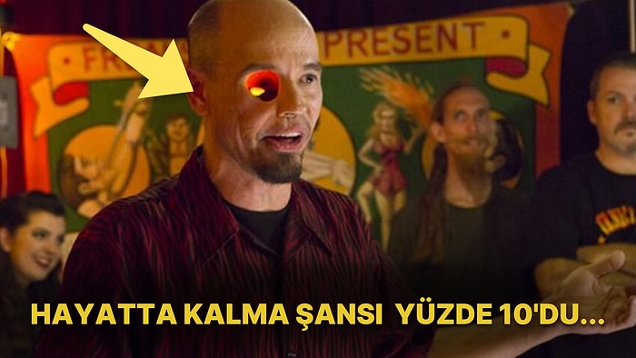 Yüzünün Önemli Bir Kısmını Kaybeden Billy Owen'in Görenleri Şaşkına Çevirme Garantili İlginç Hikayesi