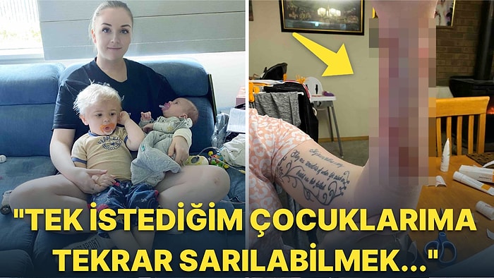 Karadul Örümceği Tarafından Isırıldığı İçin 7 Yıl Boyunca İyileşemeyen Kadının Dumur Eden Hikayesi