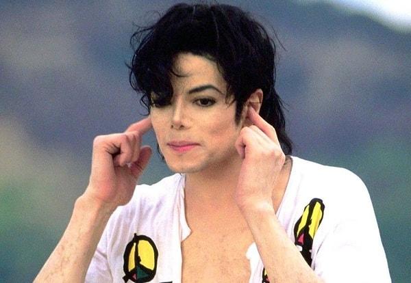 6. Michael Jackson - Vitiligo