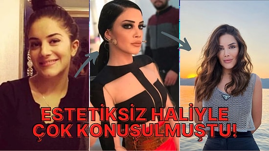 İşte Benim Stilim'de Tarzı ve Dobralığıyla Çok Ses Getiren Simay Tokatlı'nın Değişimi