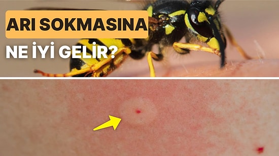 Açık Havada Yaşanan En Büyük Sorunlardan Arı Sokmasına Ne İyi Gelir ve Arı Sokması Anında Neler Yapılmalıdır?