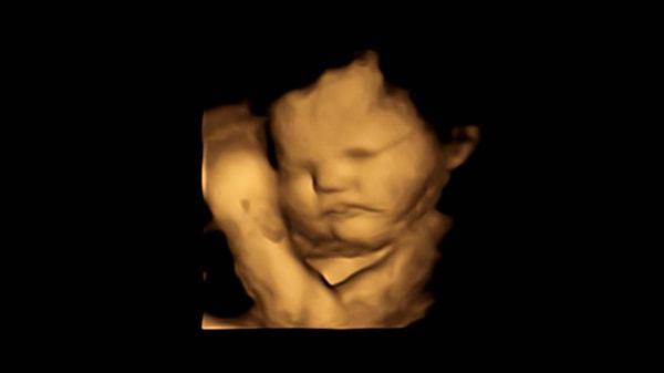 Durham Üniversitesi Psikoloji Bölümü'den Beyza Üstün'ün liderliğindeki araştırma ekibi, fetüslerin belirli tatları ayırt edip edemediğini görmek için 18-40 yaşları arasındaki 70 hamileyi iki gruba ayırıp ultrason görüntülerini inceledi. 30 kişilik bir grup da hiçbir şey yemedi.