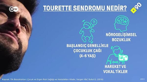 Tourette sendromu, özünü tiklerin oluşturduğu, nörobiyolojik zeminde gerçekleşen nörogelişimsel bir bozuklukmuş.