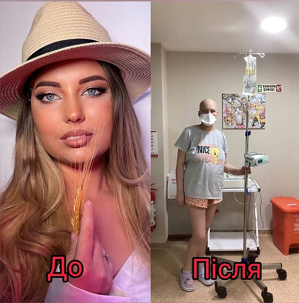 Anastasia Varfolomieieva isimli genç kadın Antalya'da gerçekleştirilen ameliyatla hayata tutundu.