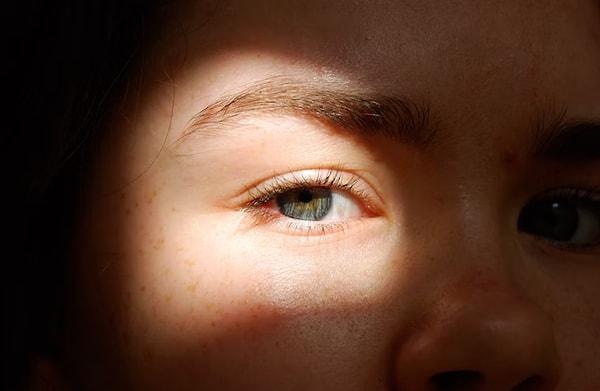 Göz renginin kalıtımı, örneğin baskın kahverengi göz genine sahip iki ebeveynin kahverengi gözlü bir çocuğa sahip olması gibi basit olabilir.