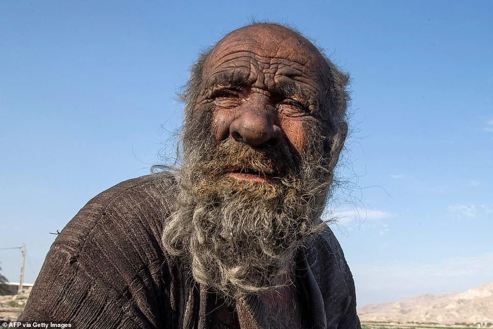 "Самый грязный человек в мире", который не принимал душ более 60 лет, умер в возрасте 94 лет