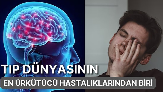 Öldüklerini Düşünüyorlar! Yürüyen Ceset Sendromu Olarak da Bilinen 'Cotard Sendromu' Nedir?