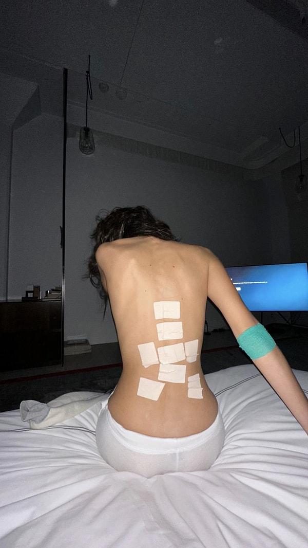 Uzun süredir Lyme hastalığından muzdarip olan Bella Hanım, sırtındaki bandajlarla hastane odasından bir fotoğraf paylaştı Instagram hesabında.