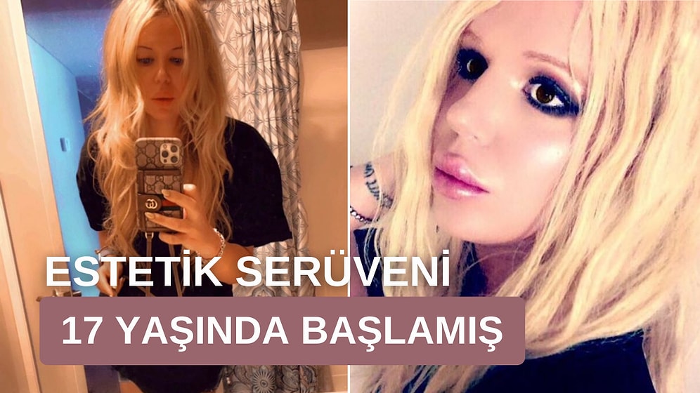 Estetikler İçin 2 Milyon TL'den Fazla Harcamış! Britney Spears'a Benzemek için Kör Olmayı Bile Göze Alan Adam